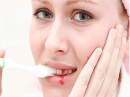 Chảy máu chân răng có phải dấu hiệu ung thư máu?