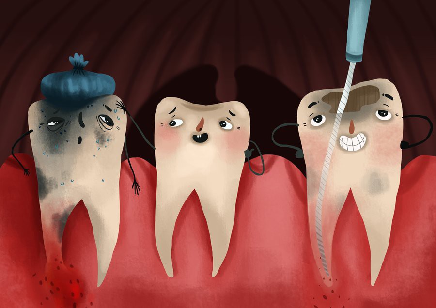 Bọc răng sứ không đảm bảo chất lượng, bạn phải đối mặt với những nguy cơ không ngờ