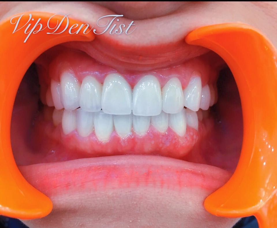 Góc Khoe Nét Đẹp Mang Thương Hiệu VIPDENTIST-179 Xã Đàn!