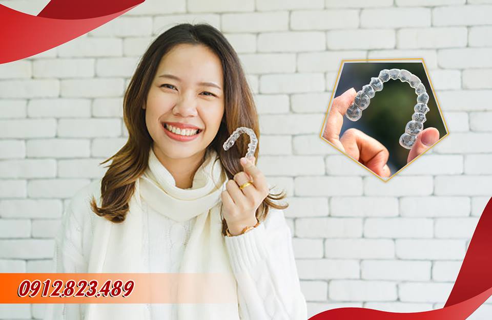 INVASALIGN - XU HƯỚNG MỜI TRONG NIỀNG RĂNG THẨM MỸ