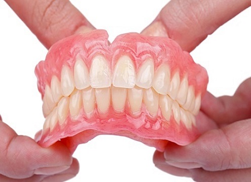 3 trường hợp nhất định không được niềng răng