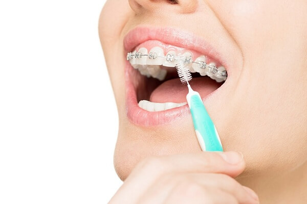 Điều cần biết trước khi 