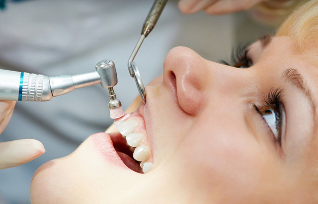 Lấy cao răng định kỳ rất có lợi