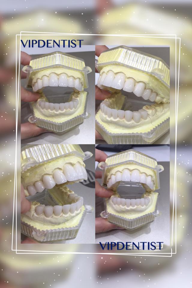 Khởi Động Ngày mới cùng Nha Khoa Quốc tế Vip Dentist!