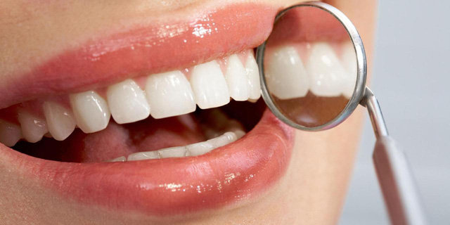 Tiết lộ 5 vấn đề sức khỏe qua răng miệng
